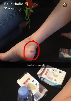 ouch bella feet